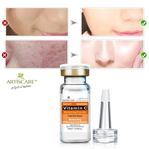 ARTISCARE Sérum de Vitamina C para el Rostro Hidratante 4 Piezas Ácido Hialurónico Cuidado Facial Esencia Nutritiva Productos para el Cuidado de la Piel