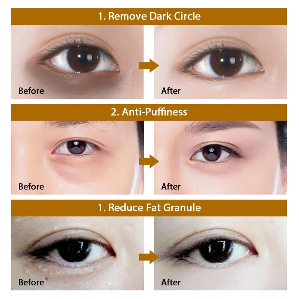 60 Pieces of Gold Hyaluronic Acid Repair Eye Mask Moisturizing and Firming Eye Patches Korean Skincare Crystal Eye Mask